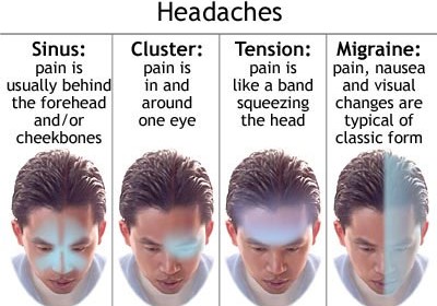 Tension Headaches